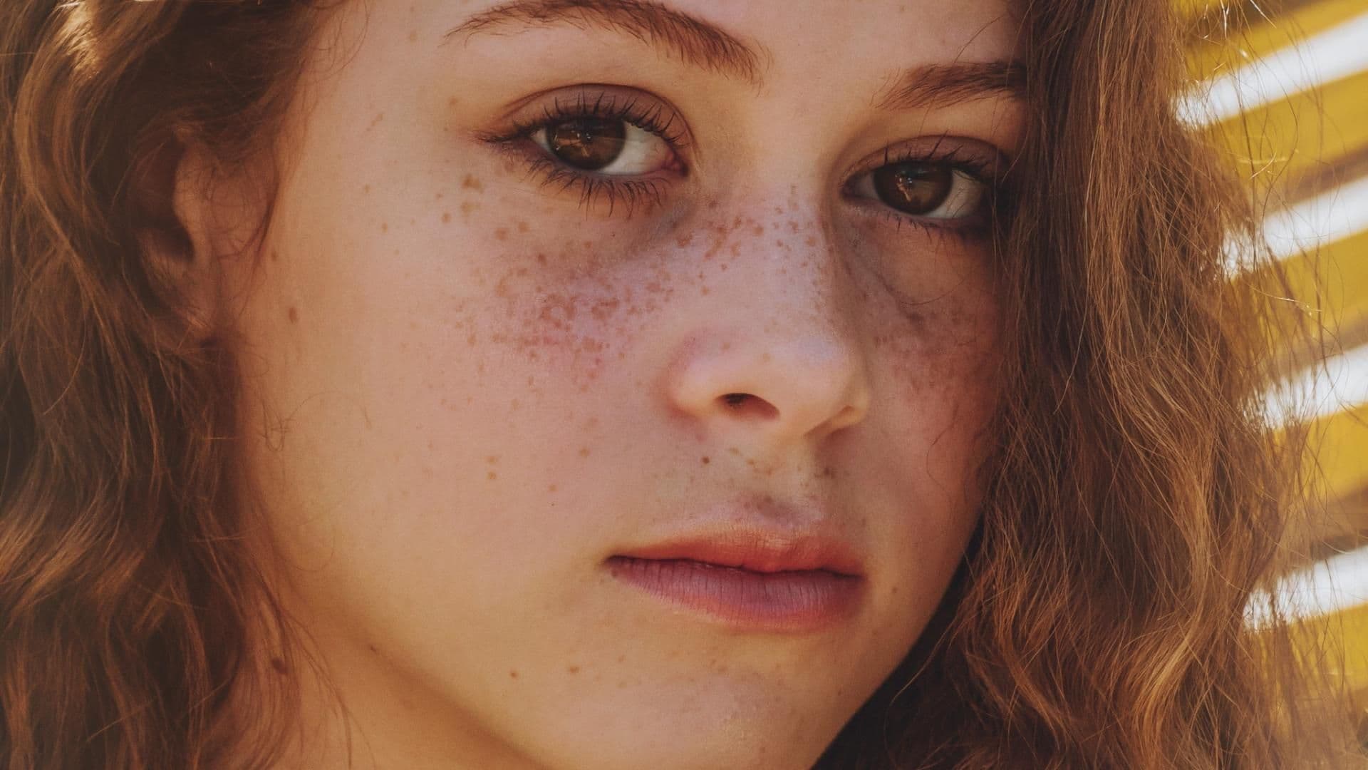 Lippenpflege im Winter Mädchen mit Sommersprossen