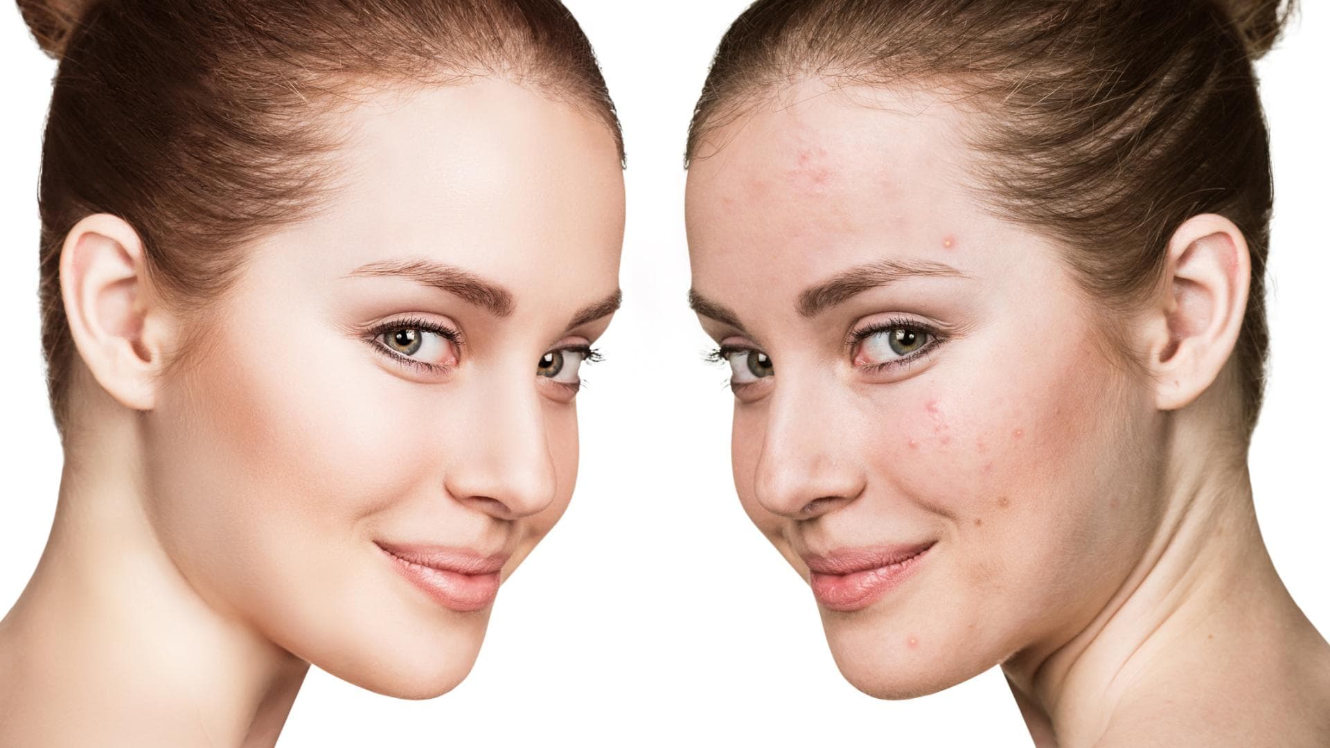 Make up unreine Haut quer Make up unreine Haut quer