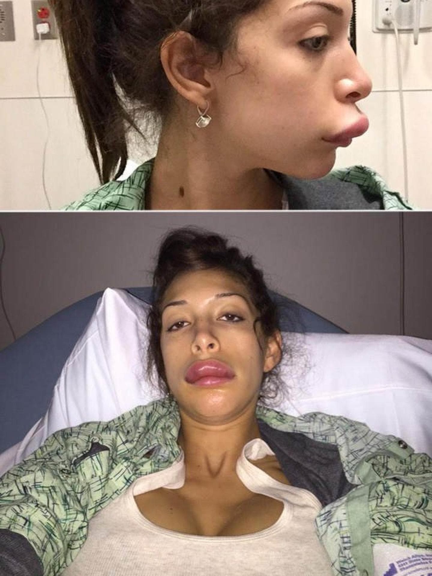 Farrah Abraham: Lippen-Implantate Farrah Abraham: Lippen-Implantate