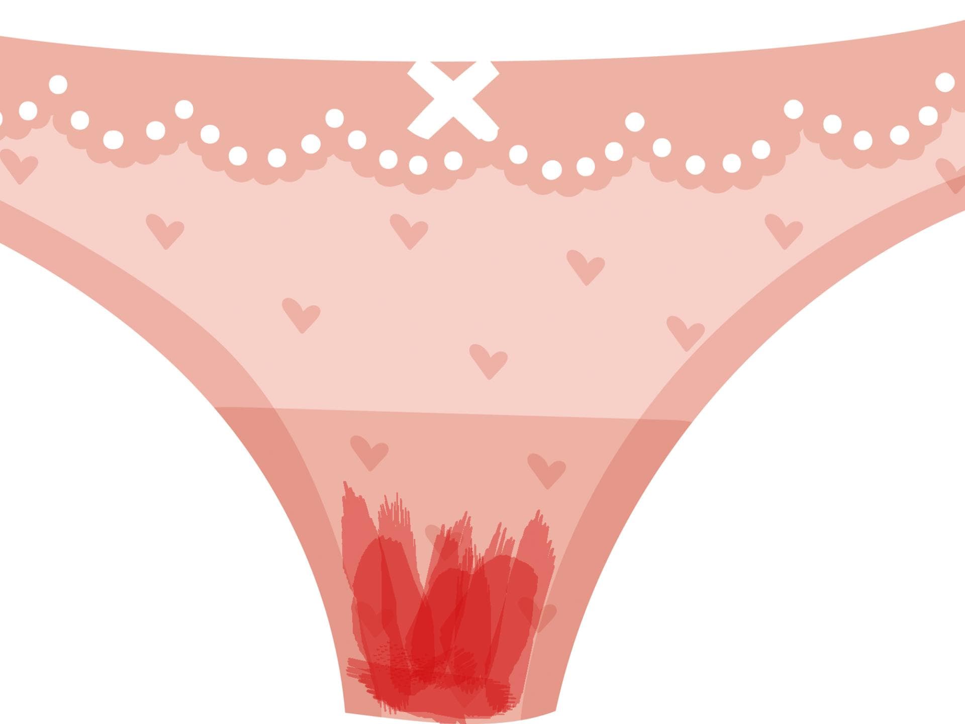 menstruationsblut-wässrig menstruationsblut-wässrig