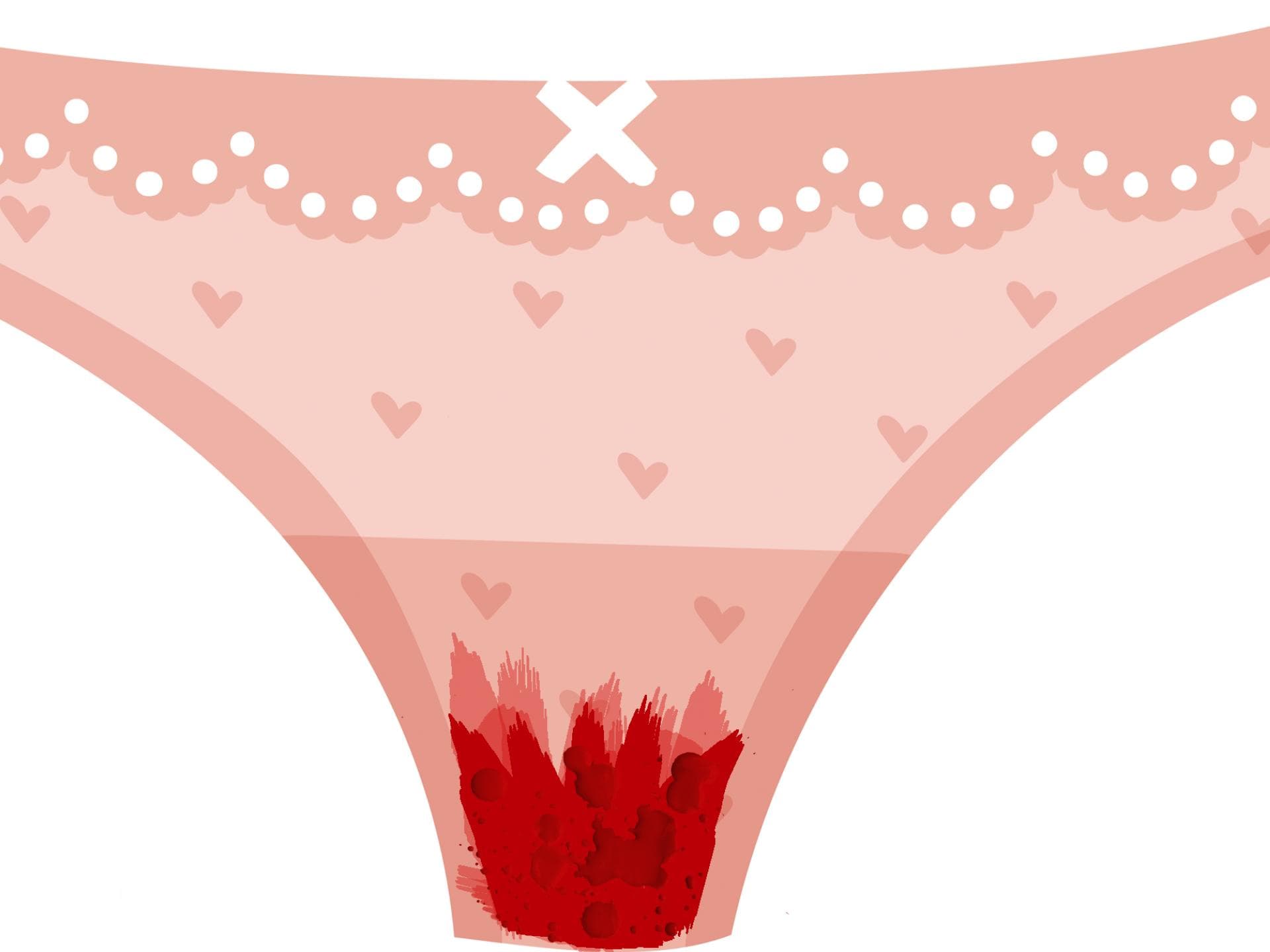 menstruationsblut-klümpchen menstruationsblut-klümpchen