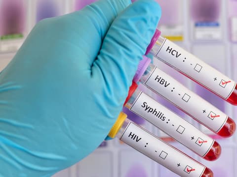 geschlechtskrankheiten-quer geschlechtskrankheiten-quer