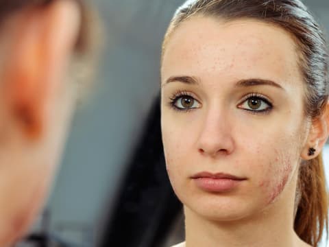 nervige-pickelratschläge-quer nervige-pickelratschläge-quer